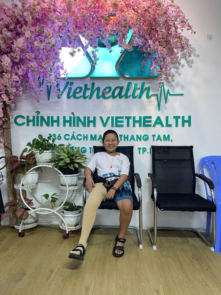Ảnh sau